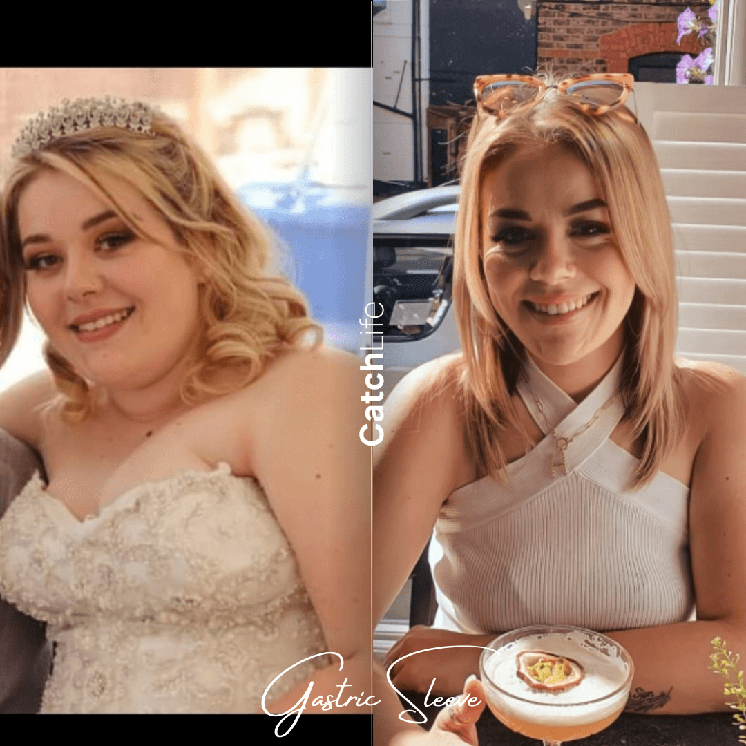 weight loss before after